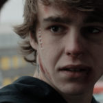 La cicatrice di Nico Mirallegro in The Habit of Beauty di Mirko Pincelli (Italia, UK 2016)